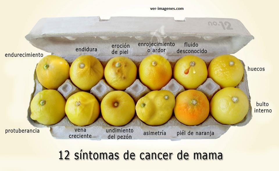 Imagen de 12 Síntomas Del Cáncer De Mama.